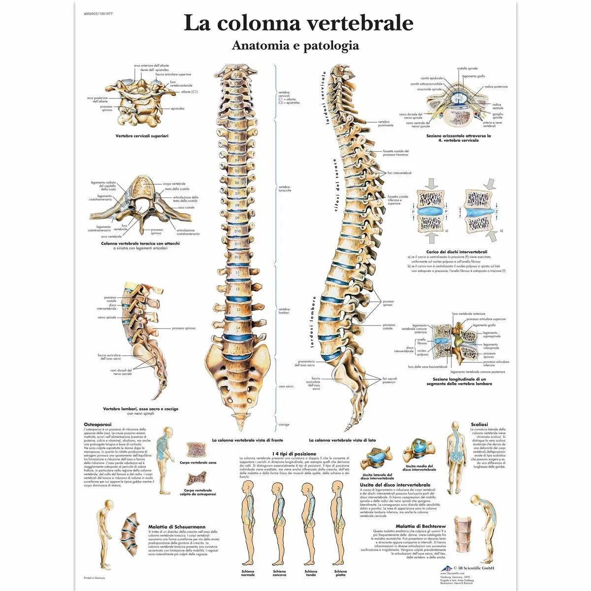 3B Scientific VR4152L la Colonna Vertebrale, Anatomia e Patologia