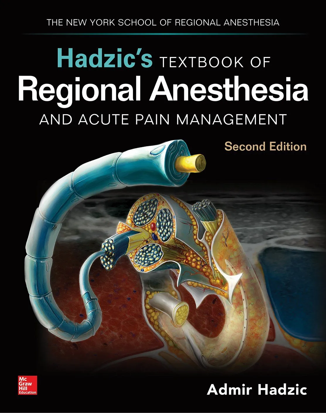 Hadzic's Textbook of Regional Anesthesia and Acute Pain Management, Second Edition (English Edition)