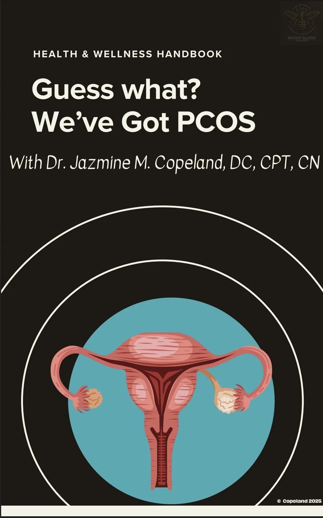 Guess What? We’ve Got PCOS (English Edition)