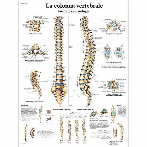 3B Scientific VR4152L la Colonna Vertebrale, Anatomia e Patologia