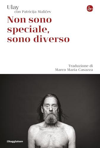 Non sono speciale, sono diverso