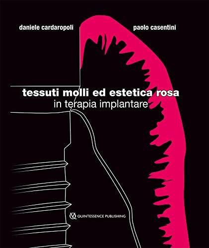 Tessuti Molli ed Estetica Rosa in Terapia Implantare