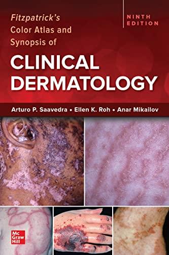 Fitzpatrick's Color Atlas and Synopsis of Clinical Dermatology, 9/e (English Edition)